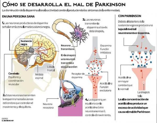 1465185384110-600x472 El Parkinson podría curarse con un fármaco para la diabetes