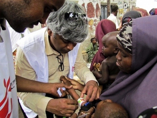 Unni-Karunakara-MSF-Mogadiscio-Somalia Jean Ziegler: las muertes por hambre son asesinatos