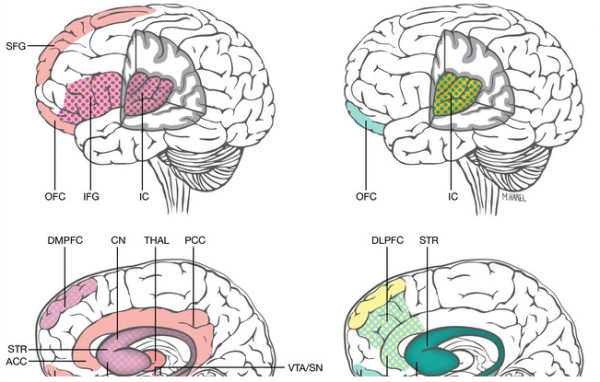 cerebro-mujeres-pospartum-600x382 Identificada la depresión posparto por un estudio neurobiológico