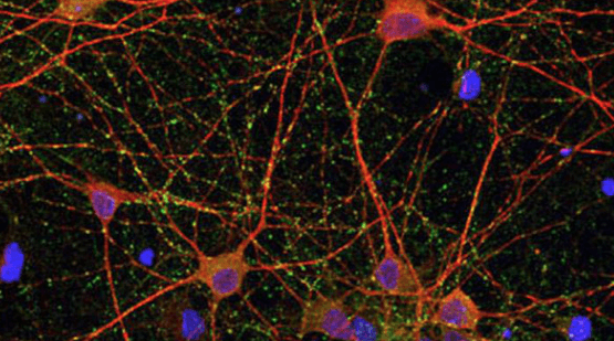 cultivos-neuronales Identificada una molécula para tratar el ictus