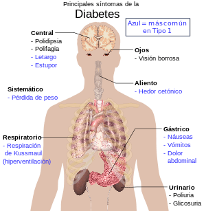 diabetes_es-svg La diabetes de tu barrio