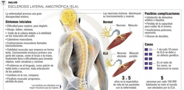 ela-600x295 Científicos descubren una posible cura para el ELA y la DFT