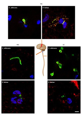 investigadores-espanoles-relacionan-la-ela-con-hongos-en-el-cerebro_image_380 Relacionan la ELA con hongos en el cerebro