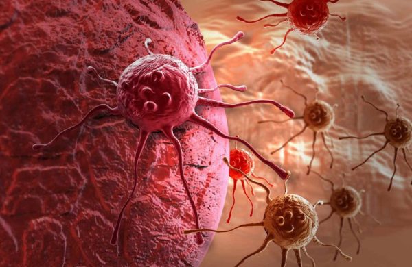 la-expansion-del-cancer-a-otras-partes-del-cuerpo-es-conocido-con-el-nombre-de-metastasis-600x390 Expertos descubren qué cambios en el ADN provocan cáncer