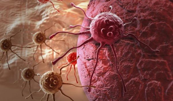 metastasis-600x351 Científicos españoles encuentran cómo se inicia la metástasis