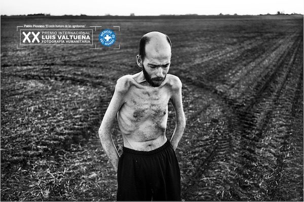 pablo-piovano_el-coste-humano-de-las-agrotoxinas-600x400 Sergei Stroitelev Premio de Fotografía Humanitaria Luis Valtueña