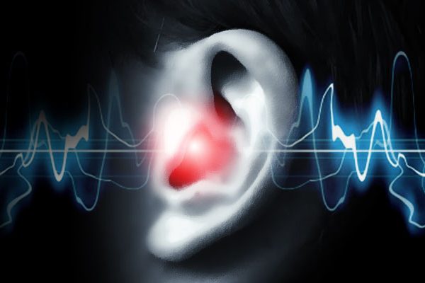 tinnitus-600x400 Científicos afirman que los antidepresivos empeoran el tinnitus