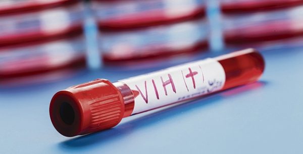 vih_1-600x305 El test del VIH podrá comprarse en farmacias sin receta médica