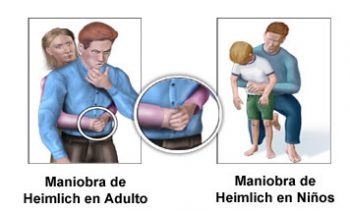 maniobra-heimlich-350x211 Atragantamiento: ¿sabes hacer la maniobra de Heimlich?