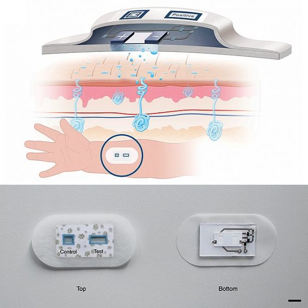 fibrosis-600x600 Fibrosis quística: un parche ayudará a diagnosticar la enfermedad