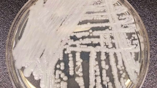 candida-auris-600x338 Cándida Auris, el hongo resistente que avanza en el mundo