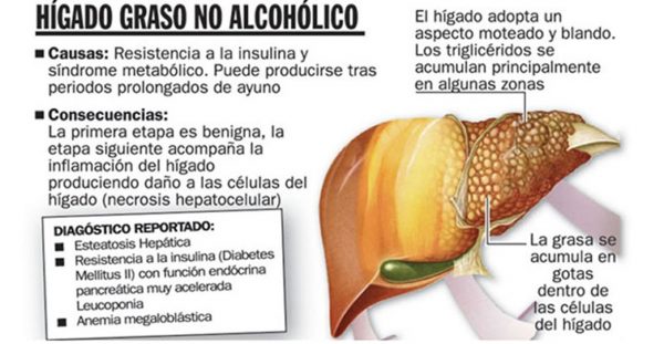 higado-graso-600x311 Hígado graso no alcohólico: una enfermedad silenciosa