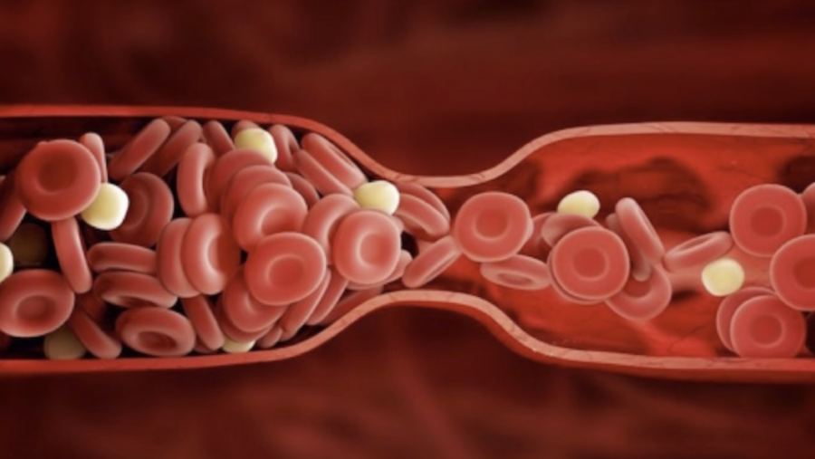 anticoagulantes-900x507 Covid-19: es efectivo el tratamiento con anticoagulantes