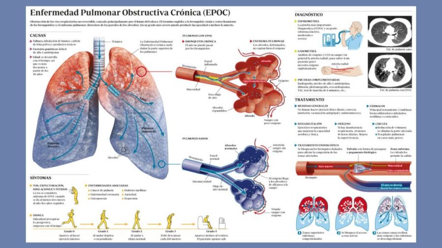 EPOC-infografia-principal-full-1024x576-1-900x506 EPOC: la silente enfermedad pulmonar