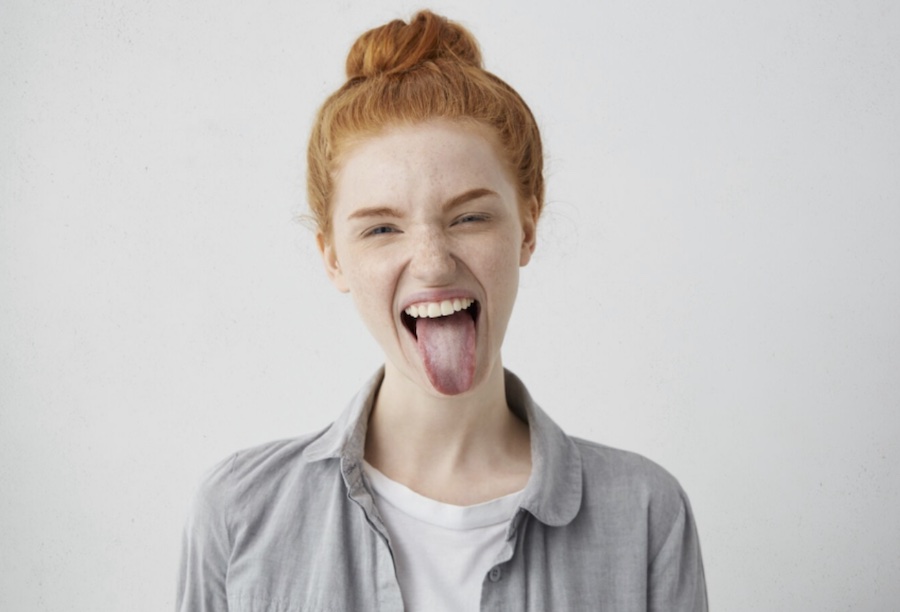 Lengua-blanca-©archivopub Lengua blanca: causas y tratamientos más comunes