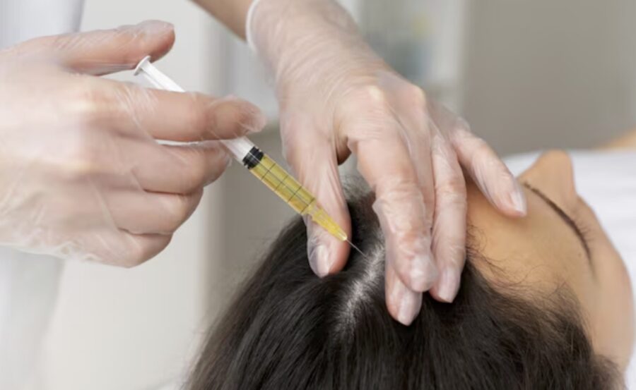 Tratamientos-capilares-eb-Evo-Clinicas-©archivopub-900x553 Tratamientos capilares para cuidar el cabello