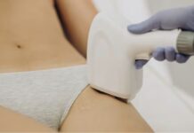 Depilación láser profesional: una inversión estratégica para los centros de estética
