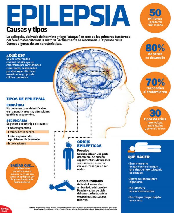 3238303431352d35-600x734 La epilepsia relacionada con el grosor del cerebro