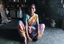 Anesvad: persona afectada por la lepra en India