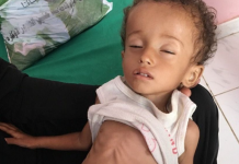 La hambruna en Yemen