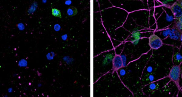 Captura-de-pantalla-2018-01-16-a-las-13.33.42-600x321 Descubren el proceso que previene la muerte neuronal