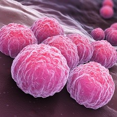 Chlamydia Clamidia, una enfermedad de transmisión sexual silenciosa