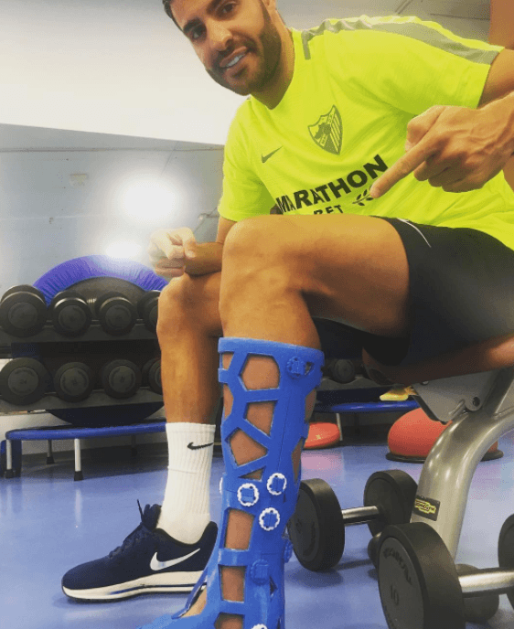 Miguel-Torres Fiixit, escayolas en 3D fabricadas en España