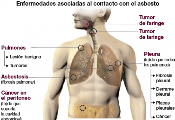 asbestos-1-350x241 Amianto: ¿cómo afecta a la salud?