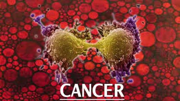 cancer1-600x338 Aumento significativo de los casos de cáncer en España