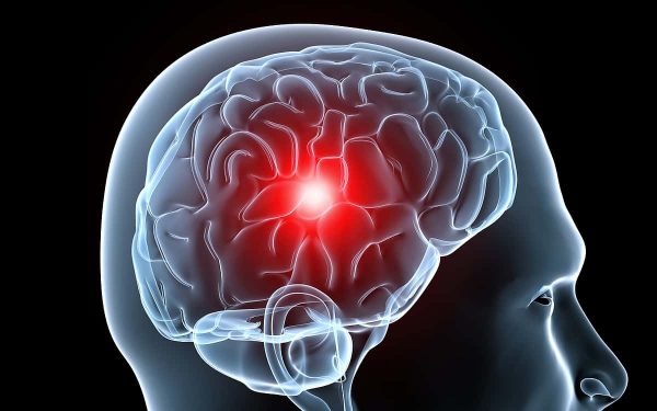 dolor_de_cabeza_cerebro-600x375 Migraña: La Unión Europea aprueba un medicamento para prevenirla