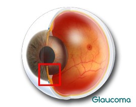 glaucoma-1 La ceguera del Glaucoma: una enfermedad evitable