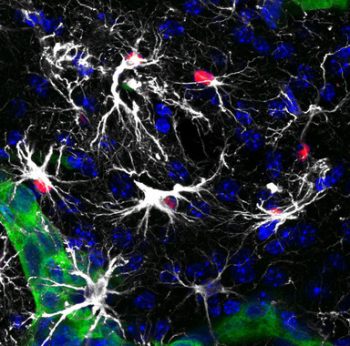 metástasis-cáncer-350x346 Cáncer: descubierta una molécula contra esta enfermedad