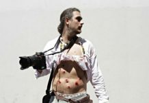 El fotoperiodista Pablo Piovano herido por postas disparadas por la policía. Fot: Agencia Pablo Urondo