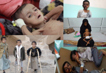 Niños afectados por la guerra en Yemen